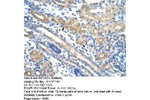 Rabbit Anti-RPUSD2 Antibody  Paraffin Embedded Tissue: Human Kidney Cellular Data: Epithelial cells of renal tubule Antibody Concentration: 4. (RPUSD2 Antikörper  (N-Term))