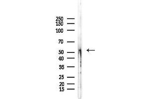 anti-DENN/MADD Domain Containing 2D (DENND2D) antibody