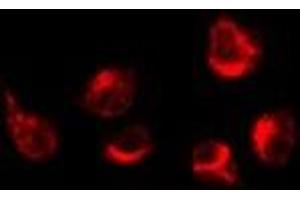 ABIN6276210 staining K562 by IF/ICC. (GPRC5A Antikörper  (Internal Region))