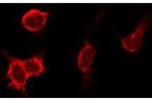 ABIN6275888 staining HeLa by IF/ICC. (Cathepsin D Antikörper  (C-Term))