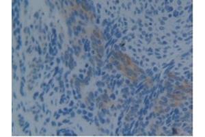 Immunohistochemistry (IHC) image for anti-Programmed Cell Death 6 Interacting Protein (PDCD6IP) (AA 1-239) antibody (ABIN7444118)