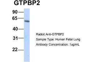 Host:  Rabbit  Target Name:  GTPBP2  Sample Type:  Human Fetal Lung  Antibody Dilution:  1. (GTPBP2 Antikörper  (N-Term))