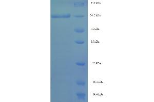 SDS-PAGE (SDS) image for Septin 7 (SEPT7) (AA 2-437) protein (His-SUMO Tag) (ABIN5711293)
