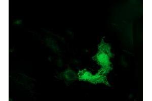 Anti-TUBB4 mouse monoclonal antibody (ABIN2454709) immunofluorescent staining of COS7 cells transiently transfected by pCMV6-ENTRY TUBB4 (RC203945). (TUBB4 Antikörper)