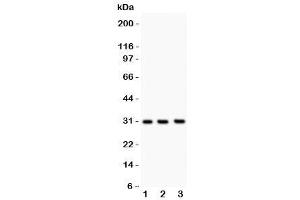 Western blot testing of PSA antibody and Lane 1:  rat brain