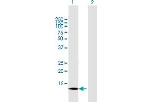 Western Blot analysis of CNIH3 expression in transfected 293T cell line by CNIH3 MaxPab polyclonal antibody. (CNIH3 Antikörper  (AA 1-160))