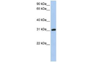 WB Suggested Anti-DKKL1 Antibody Titration: 0. (DKK1 Antikörper  (C-Term))