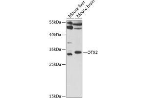 Western blot analysis of extracts of various cell lines, using OTX2 antibody (ABIN6131791, ABIN6145091, ABIN6145093 and ABIN6221138) at 1:1000 dilution. (OTX2 Antikörper  (AA 140-280))