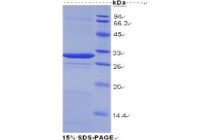 SDS-PAGE analysis of Human Galectin 3 Protein.