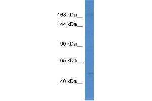 WB Suggested Anti-Setd5 Antibody   Titration: 1. (SETD5 Antikörper  (N-Term))