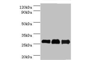 Western blot All lanes: B-cell lymphoma/leukemia 10 antibody at 9 μg/mL Lane 1: Mouse gonad tissue Lane 2: MCF-7 whole cell lysate Lane 3: NIH/3T3 whole cell lysate Secondary Goat polyclonal to rabbit IgG at 1/10000 dilution Predicted band size: 26 kDa Observed band size: 26 kDa (Cyclin D1 Antikörper  (AA 1-233))