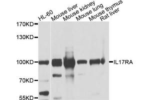 Western blot analysis of extracts of various cell lines, using IL17RA antibody. (IL17RA Antikörper)