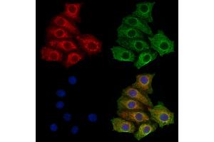 ABIN7094729 and ABIN7098780 staining HepG2 cells by IF/ICC. (STS Antikörper  (C-Term))