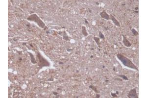 DAB staining on IHC-P; Samples: Rat Spinal cord Tissue (PKC delta Antikörper  (AA 347-601))