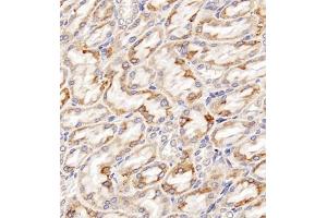 Immunohistochemistry of paraffin embedded rat kidney using Clcn5 (ABIN7073471) at dilution of 1:200 (400x lens) (Chloride Channel 5 Antikörper)