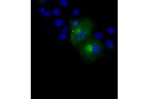 Image no. 12 for anti-Amyloid beta (A4) Precursor Protein (APP) antibody (ABIN1496877) (APP Antikörper)
