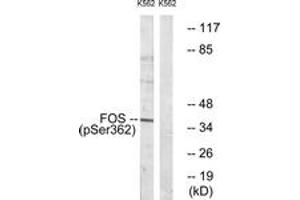 Western blot analysis of extracts from K562 cells treated with forskolin 40nM 30', using Fos (Phospho-Ser362) Antibody. (c-FOS Antikörper  (pSer362))