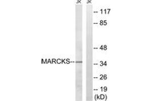 Western blot analysis of extracts from Jurkat cells, using MARCKS (Ab-158) Antibody. (MARCKS Antikörper  (AA 126-175))