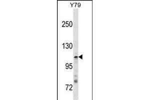 JMY Antibody (N-term) (ABIN1881469 and ABIN2838360) western blot analysis in Y79 cell line lysates (35 μg/lane).