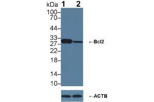 Western blot analysis of (1) Wild-type Jurkat cell lysate, and (2) Bcl2 knockout Jurkat cell lysate, using Rabbit Anti-Human BCL2 Antibody (3 µg/ml) and HRP-conjugated Goat Anti-Mouse antibody (abx400001, 0. (Bcl-2 Antikörper  (AA 2-211))