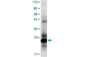 Image no. 2 for Tumor Necrosis Factor (Ligand) Superfamily, Member 13b (TNFSF13B) (AA 136-285) protein (His-DYKDDDDK-Strep II Tag) (ABIN1323223) (BAFF Protein (AA 136-285) (His-DYKDDDDK-Strep II Tag))