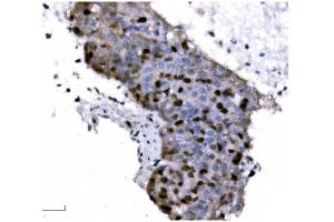 IHC analysis of Ki67 using anti-Ki67 antibody (ABIN7601101).