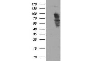 Western Blotting (WB) image for anti-SRY (Sex Determining Region Y)-Box 5 (SOX5) antibody (ABIN1501082) (SOX5 Antikörper)