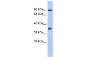 Image no. 1 for anti-Chromosome 6 Open Reading Frame 154 (C6orf154) (AA 179-228) antibody (ABIN6743771) (C6orf154 Antikörper  (AA 179-228))