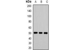 Western blot analysis of VRK1 expression in Jurkat (A), A549 (B), Hela (C) whole cell lysates. (VRK1 Antikörper)