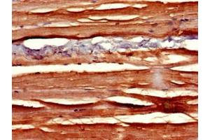 Immunohistochemistry of paraffin-embedded human skeletal muscle tissue using ABIN7169811 at dilution of 1:100 (SLIT3 Antikörper  (AA 1199-1494))