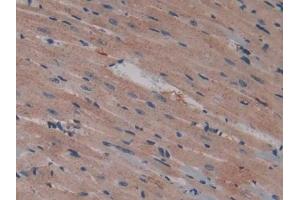 DAB staining on IHC-P; Samples: Mouse Heart Tissue (Talin Antikörper  (AA 975-1181))