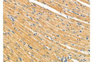 ABIN6265714 and ABIN6277332 at 1/100 staining Rat heart tissue by IHC-P.