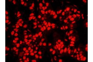 Immunofluorescence (IF) image for anti-Nucleophosmin (Nucleolar phosphoprotein B23, Numatrin) (NPM1) (AA 250-294) antibody (ABIN7448992)