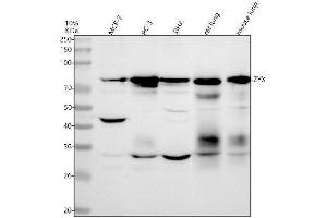 Western blot analysis of Zyxin using anti-Zyxin antibody (ABIN7606745).