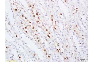 Formalin-fixed and paraffin embedded rat kidney tissue labeled with Anti ZHX2/Alpha fetoprotein regulator 1 Polyclonal Antibody, Unconjugated  at 1:100 followed by conjugation to the secondary antibody and DAB staining (ZHX2 Antikörper  (AA 451-550))