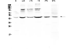 Western blot analysis of DC-SIGN using anti-DC-SIGN antibody . (DC-SIGN/CD209 Antikörper)