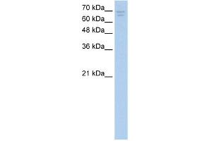 WB Suggested Anti-CACNB2 Antibody Titration:  2.
