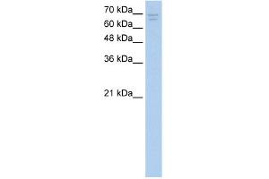 WB Suggested Anti-CACNB2 Antibody Titration:  2. (CACNB2 Antikörper  (Middle Region))