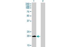 Western Blot analysis of LYPD5 expression in transfected 293T cell line by LYPD5 MaxPab polyclonal antibody. (LYPD5 Antikörper  (AA 1-208))