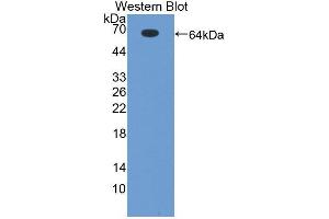 Western blot analysis of the recombinant protein. (Geminin Antikörper  (AA 1-209))