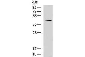 Western blot analysis of Mouse liver tissue lysate using SPI1 Polyclonal Antibody at dilution of 1:1600 (SPI1 Antikörper)