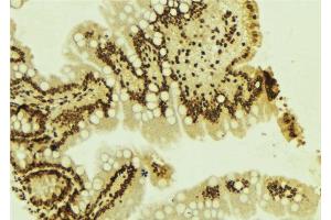 ABIN6277656 at 1/100 staining Mouse colon tissue by IHC-P. (ZEB1 Antikörper  (Internal Region))