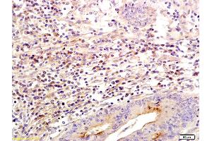 Formalin-fixed and paraffin embedded human colon labeled with Anti SLC26A4 Polyclonal Antibody, Unconjugated (ABIN721030) followed by conjugation to the secondary antibody and DAB staining (SLC26A4 Antikörper  (AA 301-400))