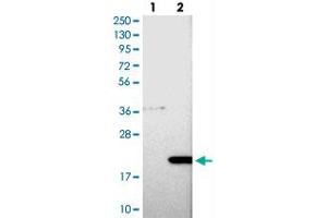 Western blot analysis of Lane 1: Negative control (vector only transfected HEK293T lysate), Lane 2: Over-expression Lysate (Co-expressed with a C-terminal myc-DDK tag (~3. (COMMD8 Antikörper)