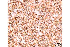 IHC testing of human tonsil (20X) stained with PD7/26 mAb.