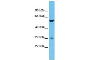 Host: Rabbit Target Name: TMPRSS11E Sample Type: Fetal Lung lysates Antibody Dilution: 1. (TMPRSS11E Antikörper  (N-Term))