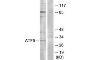 Western blot analysis of extracts from Jurkat cells, using ATF5 Antibody. (ATF5 Antikörper  (AA 221-270))
