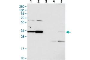 Western blot analysis of Lane 1: RT-4, Lane 2: U-251 MG, Lane 3: Human Plasma, Lane 4: Liver, Lane 5: Tonsil with C3orf26 polyclonal antibody  at 1:250-1:500 dilution.