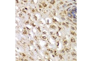 Immunohistochemistry of paraffin-embedded human esophageal using SGK1 antibody at dilution of 1:100 (400x lens).