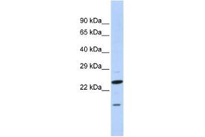 INSIG2 antibody used at 1 ug/ml to detect target protein.